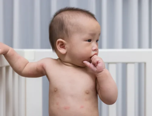 When Your Child Has a Rash: What to Watch For